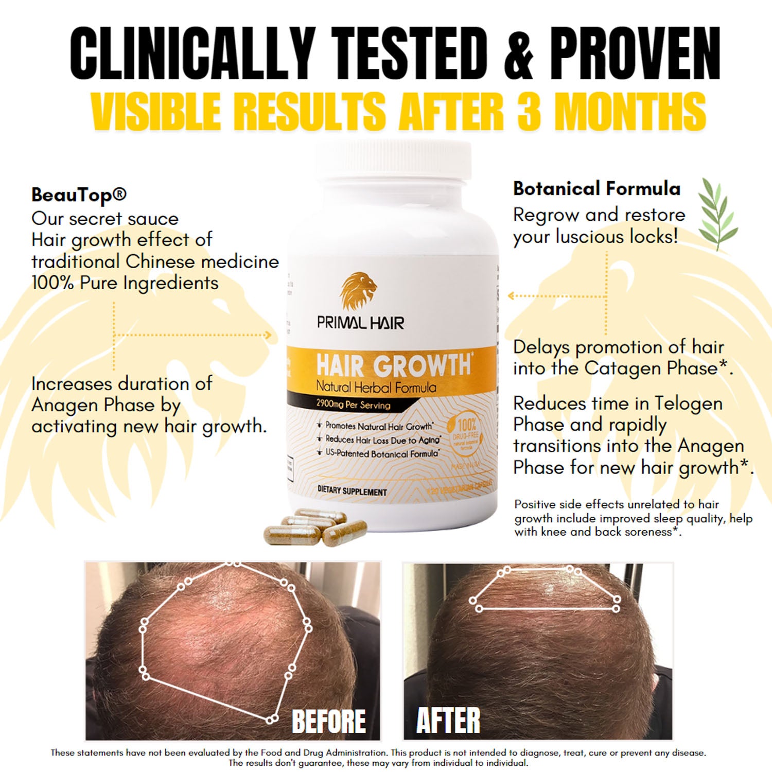 PRIMAL HAIR - Hair Growth Supplement Clinically Proven & Tested Visibly New Hair Growth