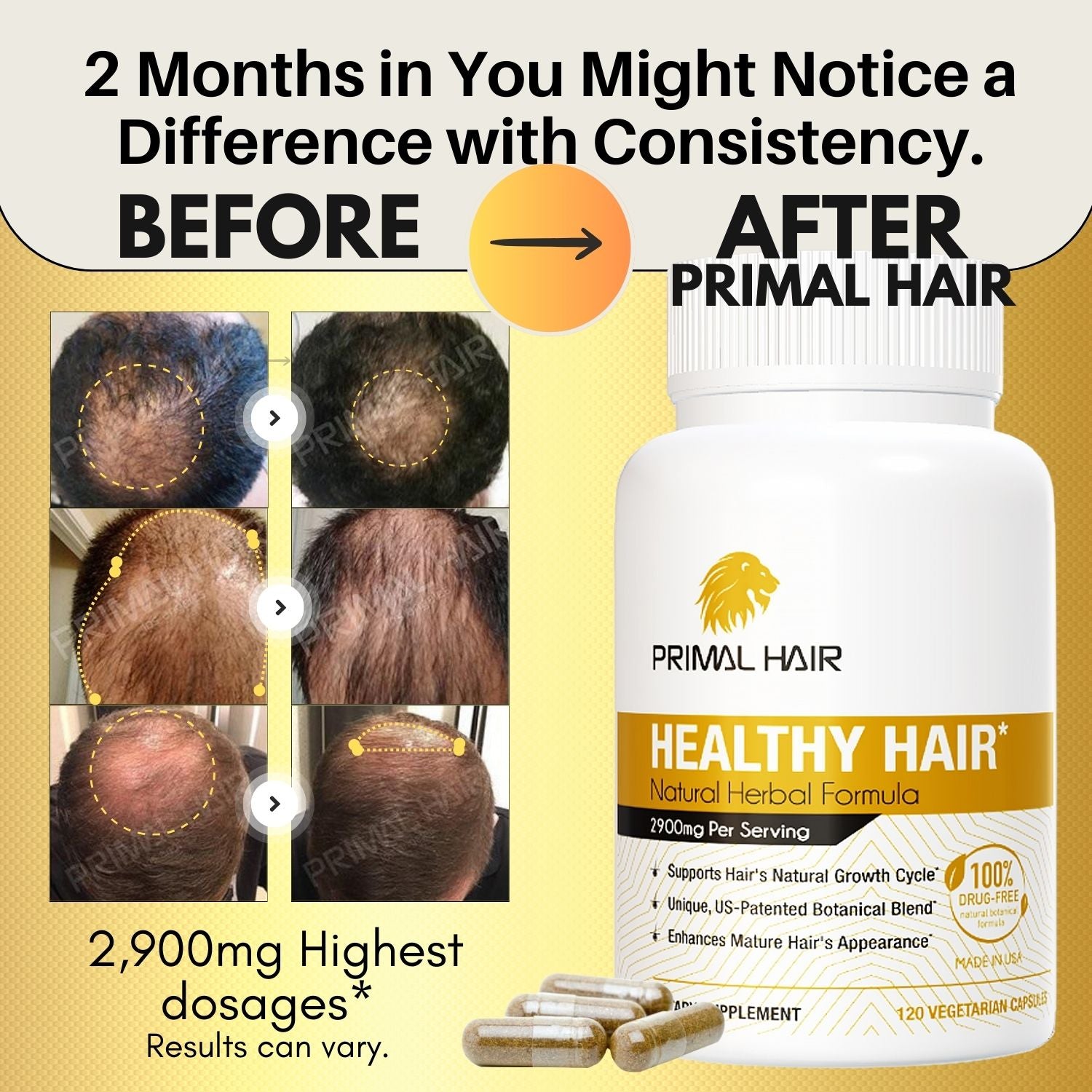 PRIMAL HAIR - Hair Support Supplement* -  30% OFF Now