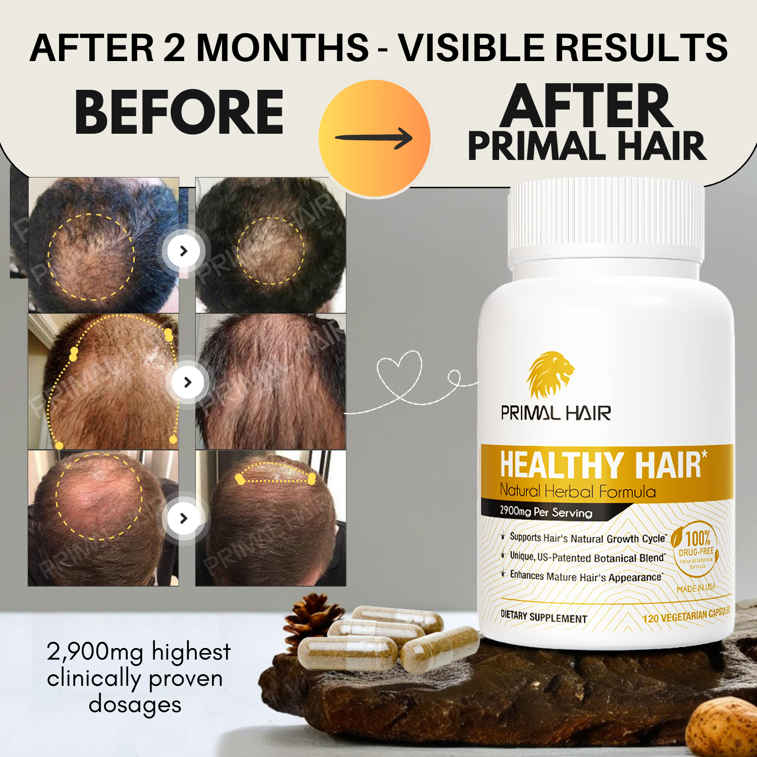 PRIMAL HAIR - Hair Growth Supplement Clinically Proven & Tested Visibly New Hair Growth